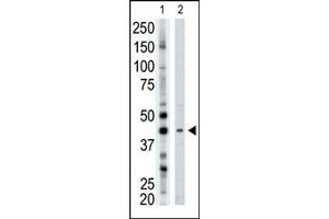 The anti-ART3 Pab (ABIN389010 and ABIN2839235) is used in Western blot to detect ART3 in mouse brain tissue lysate. (ART3 antibody  (N-Term))
