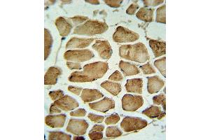 CA3 Antibody (Center) (ABIN652368 and ABIN2841753) IHC analysis in formalin fixed and paraffin embedded skeletal muscle followed by peroxidase conjugation of the secondary antibody and DAB staining. (CA3 antibody  (AA 146-177))