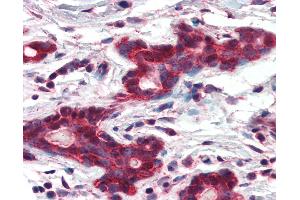 Anti-MMP14 antibody IHC of human breast. (MMP14 antibody  (AA 160-173))
