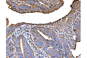 IHC analysis of RPL32 using anti-RPL32 antibody (ABIN7601826).