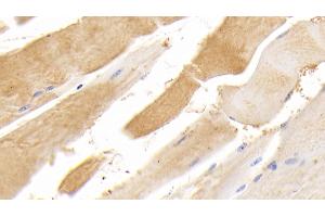 Detection of TTN in Human Skeletal muscle Tissue using Polyclonal Antibody to Titin (TTN) (Titin antibody  (AA 33779-34025))