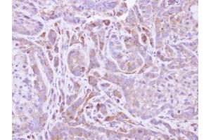 IHC-P Image Immunohistochemical analysis of paraffin-embedded A549 xenograft, using FMO2, antibody at 1:500 dilution.