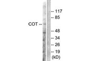 Western blot analysis of extracts from 293 cells, treated with LPS 100ng/ml 30', using COT (Ab-290) Antibody. (CROT antibody  (AA 256-305))