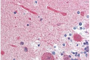 Human Brain, Cerebellum (formalin-fixed, paraffin-embedded) stained with Calmodulin antibody ABIN364349 at 10 ug/ml followed by biotinylated anti-mouse IgG secondary antibody ABIN481714, alkaline phosphatase-streptavidin and chromogen. (Calmodulin 1 antibody  (AA 1-149))