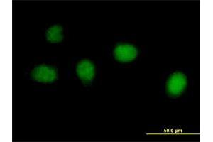Immunofluorescence of purified MaxPab antibody to C1orf73 on HeLa cell. (INTS7 antibody  (AA 1-962))