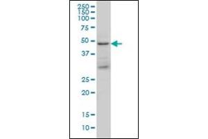 Western Blotting (WB) image for anti-Tumor Susceptibility Gene 101 (TSG101) antibody (ABIN781822) (TSG101 antibody)