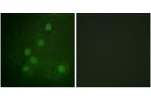 Immunofluorescence analysis of COS7 cells, using RAD52 (Ab-104) Antibody.