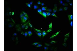 Immunofluorescence staining of Hela cells with ABIN7170532 at 1:200, counter-stained with DAPI. (VIPAR antibody  (AA 1-493))