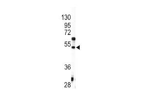Western blot analysis of anti-AGT Antibody (C-term) (ABIN392328 and ABIN2841975) in HepG2 cell line lysates (35 μg/lane). (AGT antibody  (C-Term))