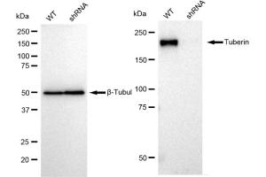Western blotting analysis using Tuberin antibody (ABIN7800658). (Recombinant Tuberin antibody)