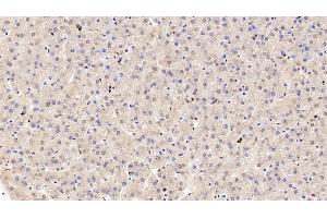 Detection of COMT in Human Liver Tissue using Polyclonal Antibody to Catechol-O-Methyltransferase (COMT) (COMT antibody  (AA 52-271))
