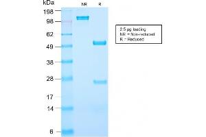 SDS-PAGE Analysis Purified PSA Rabbit Recombinant Monoclonal Antibody (KLK3/2871R).