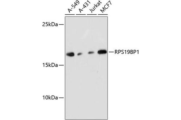 RPS19BP1 抗体  (AA 1-136)