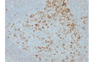 Formalin-fixed, paraffin-embedded human Lymph Node stained with Proliferation Marker Mouse Monoclonal Antibody (JC1). (Proliferation Marker antibody)