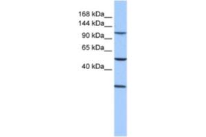 Western Blotting (WB) image for anti-Stromal Antigen 3 (STAG3) antibody (ABIN2463593) (STAG3 antibody)