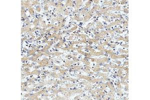 anti-ATPase, Ca++ Transporting, Ubiquitous (ATP2A3) (AA 1-30), (N-Term) antibody