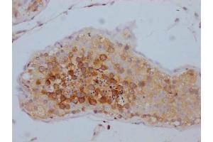 IHC image of ABIN7127834 diluted at 1:100 and staining in paraffin-embedded human testis tissue performed on a Leica BondTM system. (Recombinant TACC3 antibody)