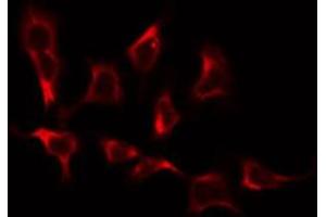ABIN6274923 staining COLO205 by IF/ICC. (BRP44L antibody  (Internal Region))