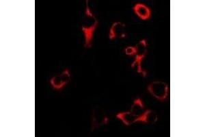 Immunofluorescence (IF) image for anti-Granzyme B (GZMB) antibody (ABIN7307858)