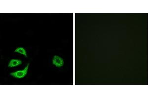 Immunofluorescence analysis of A549 cells, using ACOT8 antibody. (ACOT8 antibody)