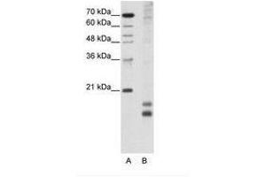 Image no. 1 for anti-Transcription Factor MafF (MAFF) (AA 33-82) antibody (ABIN203018) (MafF antibody  (AA 33-82))
