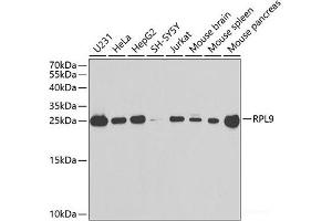 Western blot analysis of extracts of various cell lines using RPL9 Polyclonal Antibody at dilution of 1:1000. (RPL9 antibody)