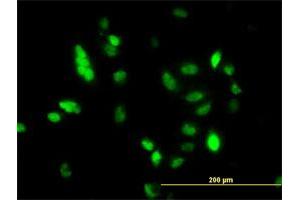 Immunofluorescence of monoclonal antibody to UBE2C on HeLa cell. (UBE2C antibody  (AA 70-179))