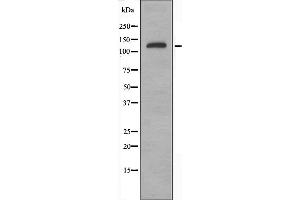 Western blot analysis of extracts from HepG2 cells using ATXN2 antibody.