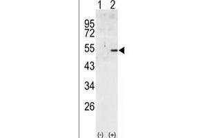 Western blot analysis of CCNA2 (arrow) using rabbit polyclonal CCNA2 Antibody (C-term) (ABIN391455 and ABIN2841432).