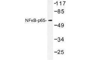 Image no. 1 for anti-Nuclear Factor-kB p65 (NFkBP65) antibody (ABIN317854) (NF-kB p65 antibody)