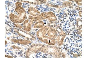 Immunohistochemistry (IHC) image for anti-GDP-Mannose Pyrophosphorylase B (GMPPB) (C-Term) antibody (ABIN2783544) (GMPPB antibody  (C-Term))