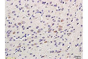 Formalin-fixed and paraffin embedded: rat brain tissue labeled with Anti-GAP-43 Polyclonal Antibody, Unconjugated (ABIN725555) at 1:200 followed by conjugation to the secondary antibody and DAB staining
