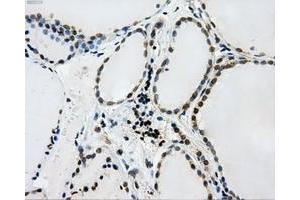 Immunohistochemical staining of paraffin-embedded Kidney tissue using anti-L1CAMmouse monoclonal antibody. (L1CAM antibody)