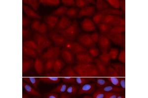 Immunofluorescence (IF) image for anti-Bridging Integrator 1 (BIN1) antibody (ABIN7259755)
