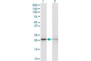 Western Blot analysis of RPS5 expression in transfected 293T cell line by RPS5 monoclonal antibody (M01), clone 3G3.