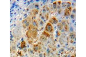 #VALUE! (IL-11 antibody  (AA 22-199))