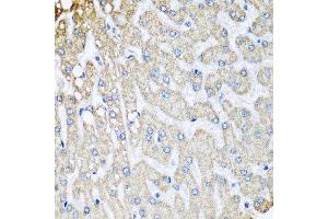 Immunohistochemistry of paraffin-embedded human liver injury using COX5B antibody at dilution of 1:100 (x40 lens). (COX5B antibody)