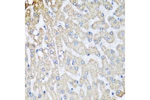 Immunohistochemistry of paraffin-embedded human liver injury using COX5B antibody at dilution of 1:100 (x40 lens).