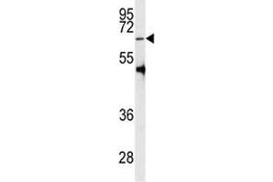 Western Blotting (WB) image for anti-Protein Arginine Methyltransferase 5 (PRMT5) (AA 473-499) antibody (ABIN3032361)