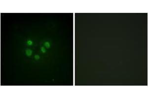 Immunofluorescence analysis of A549 cells, using Bloom Syndrome (Ab-99) Antibody. (Bloom Syndrome (AA 65-114) antibody)