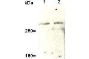 Western Blotting (WB) image for anti-Ataxia Telangiectasia and Rad3 Related (ATR) antibody (ABIN1449281) (ATR antibody)