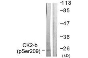 Western blot analysis of extracts from HuvEc cells, using CKII-beta (Phospho-Ser209) Antibody. (CSNK2B antibody  (pSer209))