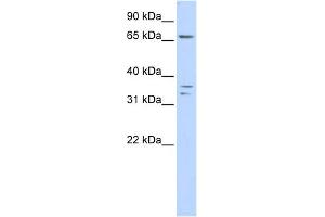 WB Suggested Anti-IQCE Antibody Titration: 0. (IQCE antibody  (Middle Region))