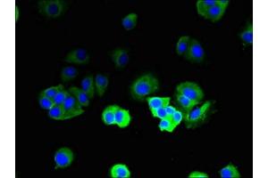 Immunofluorescent analysis of MCF-7 cells using ABIN7171285 at dilution of 1:100 and Alexa Fluor 488-congugated AffiniPure Goat Anti-Rabbit IgG(H+L) (TRBC1 antibody  (AA 1-176))