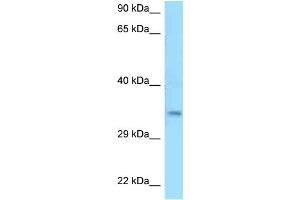 WB Suggested Anti-C9orf30 Antibody Titration: 1. (MSANTD3 antibody  (C-Term))