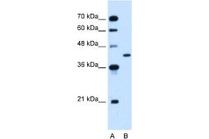 WB Suggested Anti-GOT2 Antibody Titration:  1. (GOT2 antibody  (N-Term))