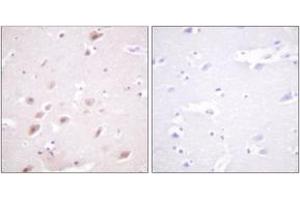 Immunohistochemistry analysis of paraffin-embedded human brain, using CKII-beta (Phospho-Ser209) Antibody. (CSNK2B antibody  (pSer209))