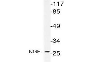 Western blot analysis of NGF Antibody in extracts from Jurkat cells.