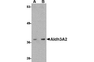 Western Blotting (WB) image for anti-Aldehyde Dehydrogenase 3 Family, Member A2 (ALDH3A2) (C-Term) antibody (ABIN1030231) (ALDH3A2 antibody  (C-Term))