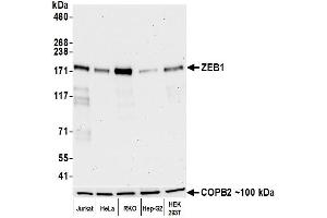 Western Blotting (WB) image for anti-Zinc Finger E-Box Binding Homeobox 1 (ZEB1) (AA 750-800) antibody (ABIN7455173)